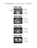 APPARATUS, METHOD, AND PROGRAM FOR DETECTING THREE DIMENMSIONAL ABDOMINAL     CAVITY REGIONS diagram and image