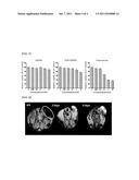 IRON OXIDE NANOPARTICLES AS MRI CONTRAST AGENTS AND THEIR PREPARING METHOD diagram and image