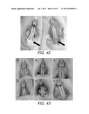 METHODS TO PREVENT CYTOTOXICITY USING N-ACETYL-CYSTEINE diagram and image