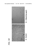 METHODS TO PREVENT CYTOTOXICITY USING N-ACETYL-CYSTEINE diagram and image