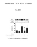 THERAPEUTIC AGENT AND DETECTION REAGENT FOR ARTERIOSCLEROTIC DISEASE WHICH     TARGETS FOR SALUSIN diagram and image