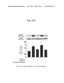 THERAPEUTIC AGENT AND DETECTION REAGENT FOR ARTERIOSCLEROTIC DISEASE WHICH     TARGETS FOR SALUSIN diagram and image