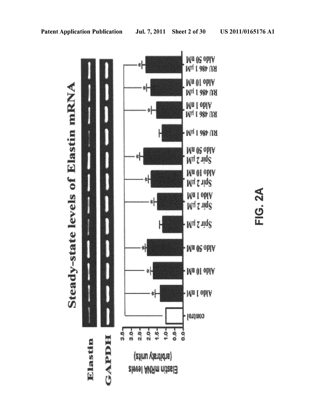 ALDOSTERONE INDUCED VASCULAR ELASTIN PRODUCTION - diagram, schematic, and image 03