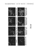 ALDOSTERONE INDUCED VASCULAR ELASTIN PRODUCTION diagram and image