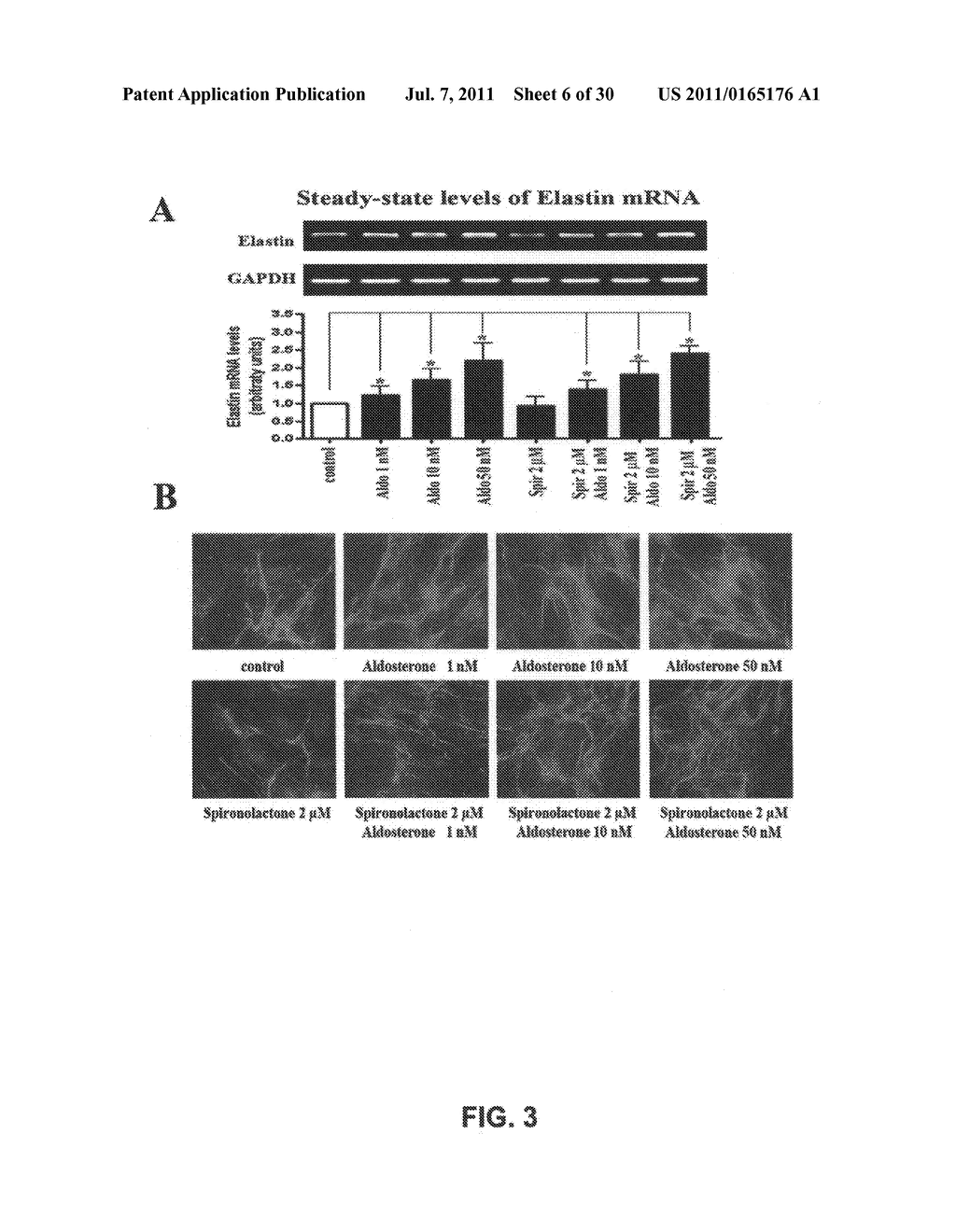 ALDOSTERONE INDUCED VASCULAR ELASTIN PRODUCTION - diagram, schematic, and image 07