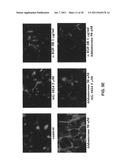 ALDOSTERONE INDUCED VASCULAR ELASTIN PRODUCTION diagram and image