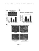 ALDOSTERONE INDUCED VASCULAR ELASTIN PRODUCTION diagram and image