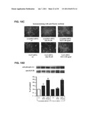 ALDOSTERONE INDUCED VASCULAR ELASTIN PRODUCTION diagram and image