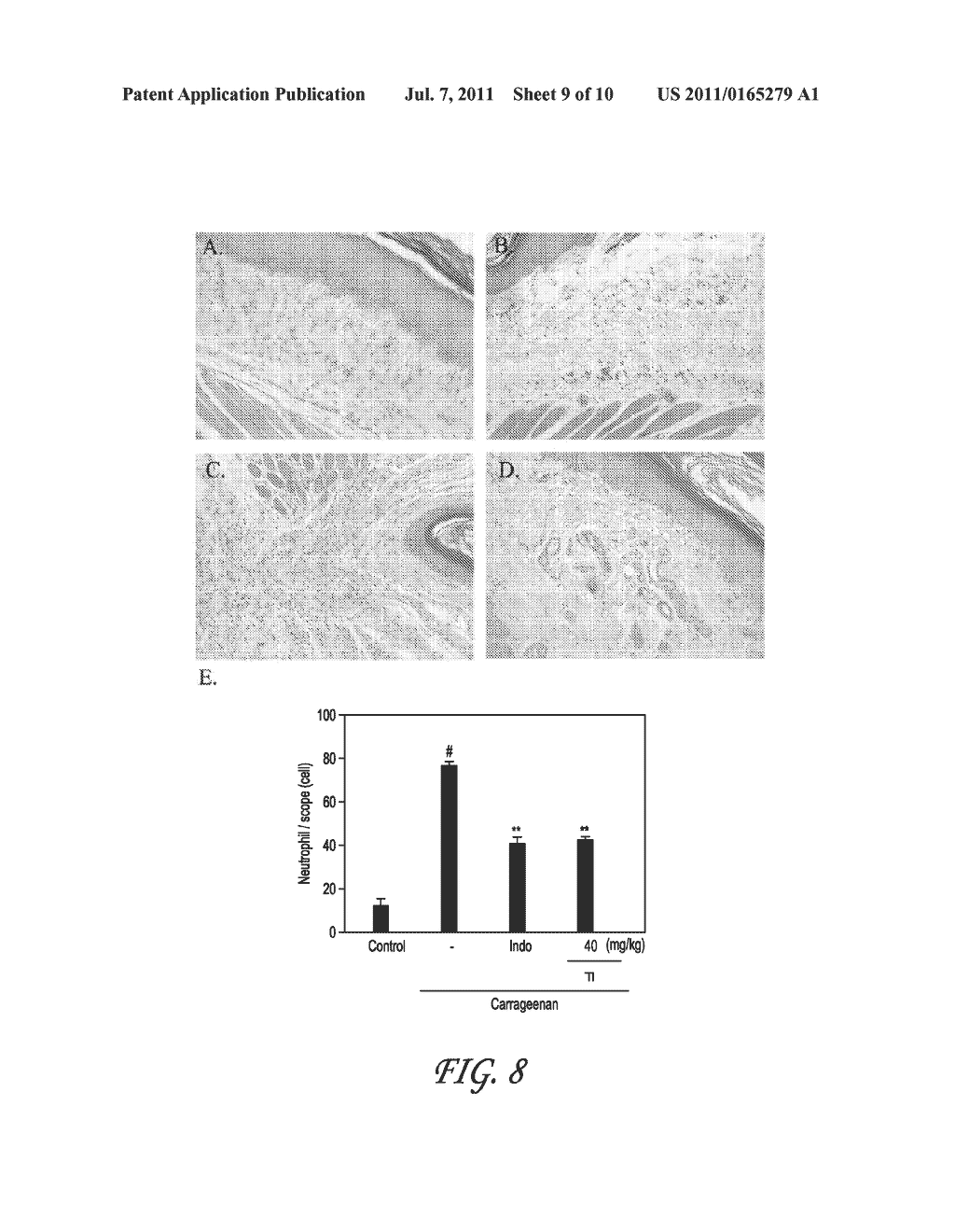 SWEET POTATO TRYPSIN INHIBITOR AND METHODS FOR TREATING INFLAMMATION AND     HYPERALGESIA - diagram, schematic, and image 10