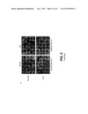 METHODS AND COMPOSITIONS FOR TREATING ALZHEIMER S DISEASE diagram and image