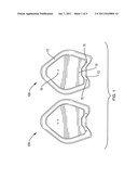 BREASTSTROKE SWIMMING TRAINING PADDLES WITH FINS diagram and image