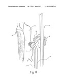 Carcass Cleaning Method, Device and Machine diagram and image