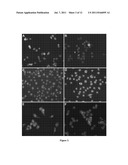 CANCER PLATINUM RESISTANCE DETECTION AND SENSITIZATION METHOD diagram and image