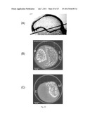 METHOD FOR TREATMENT OF BONE DISEASES AND FRACTURES diagram and image