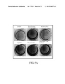 PHARMACEUTICAL COMPOSITION FOR PREVENTION AND/OR TREATMENT OF BONE LOSS diagram and image