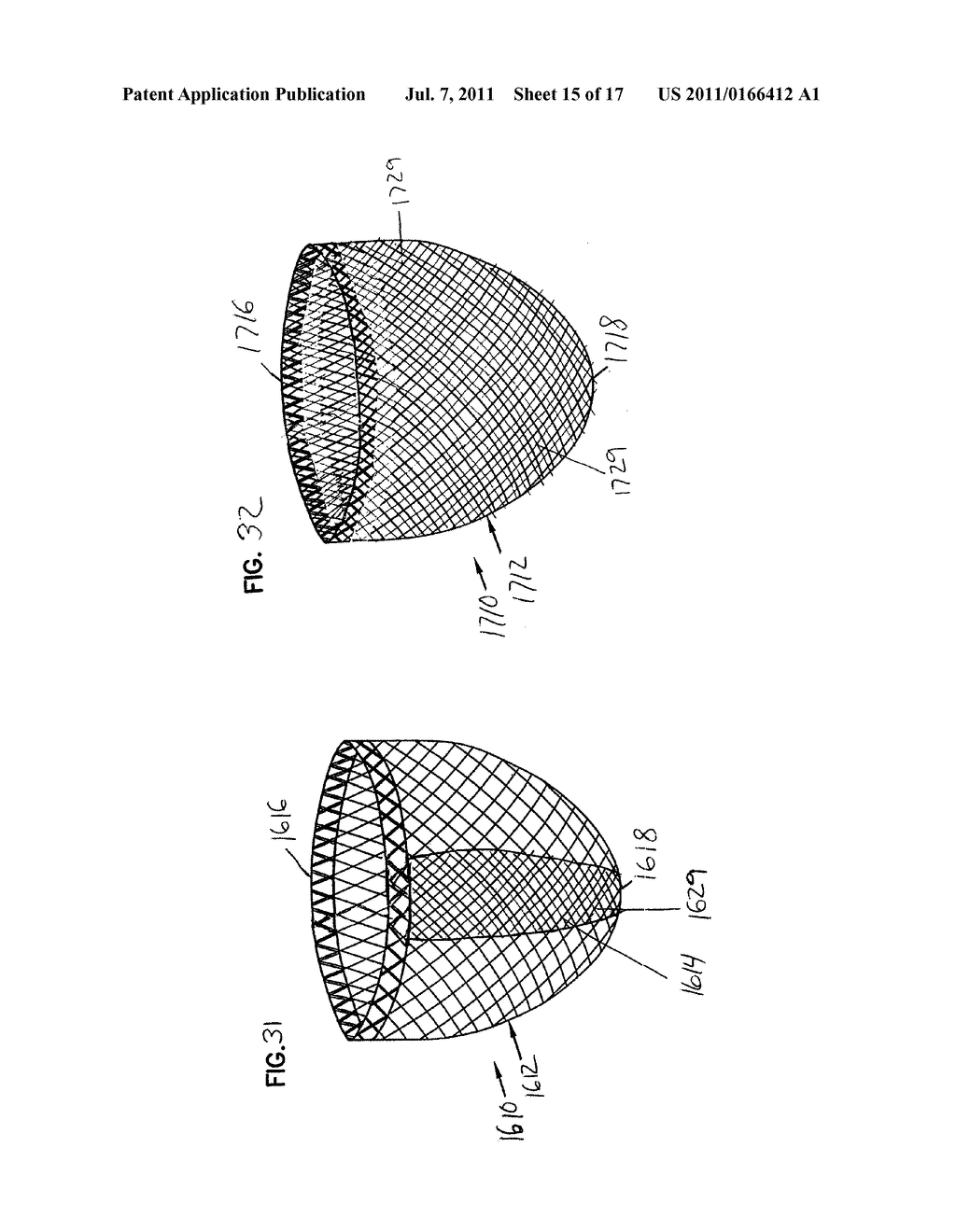 SELF-ADJUSTING ATTACHMENT STRUCTURE FOR A CARDIAC SUPPORT DEVICE - diagram, schematic, and image 16