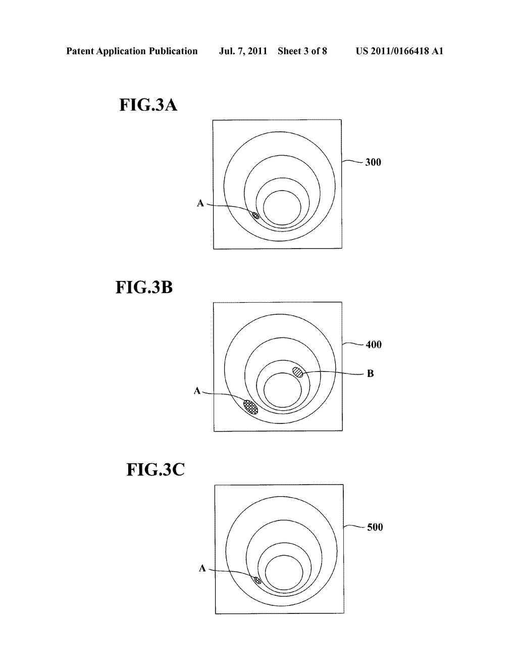 MEDICAL IMAGE PROCESSING SYSTEM AND A METHOD FOR PROCESSING A MEDICAL     IMAGE - diagram, schematic, and image 04