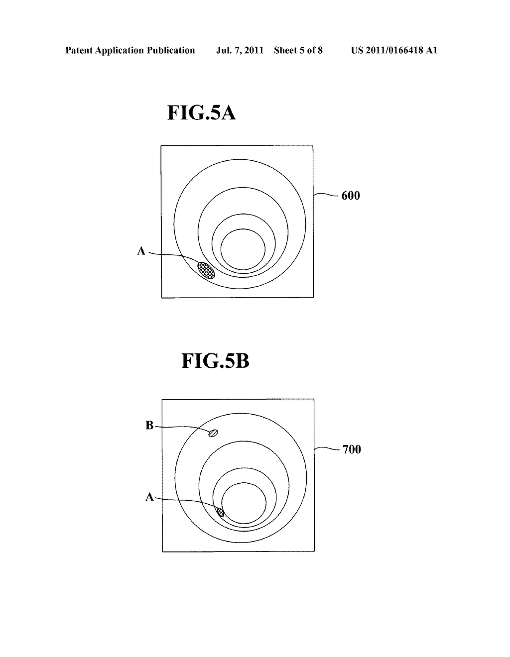 MEDICAL IMAGE PROCESSING SYSTEM AND A METHOD FOR PROCESSING A MEDICAL     IMAGE - diagram, schematic, and image 06