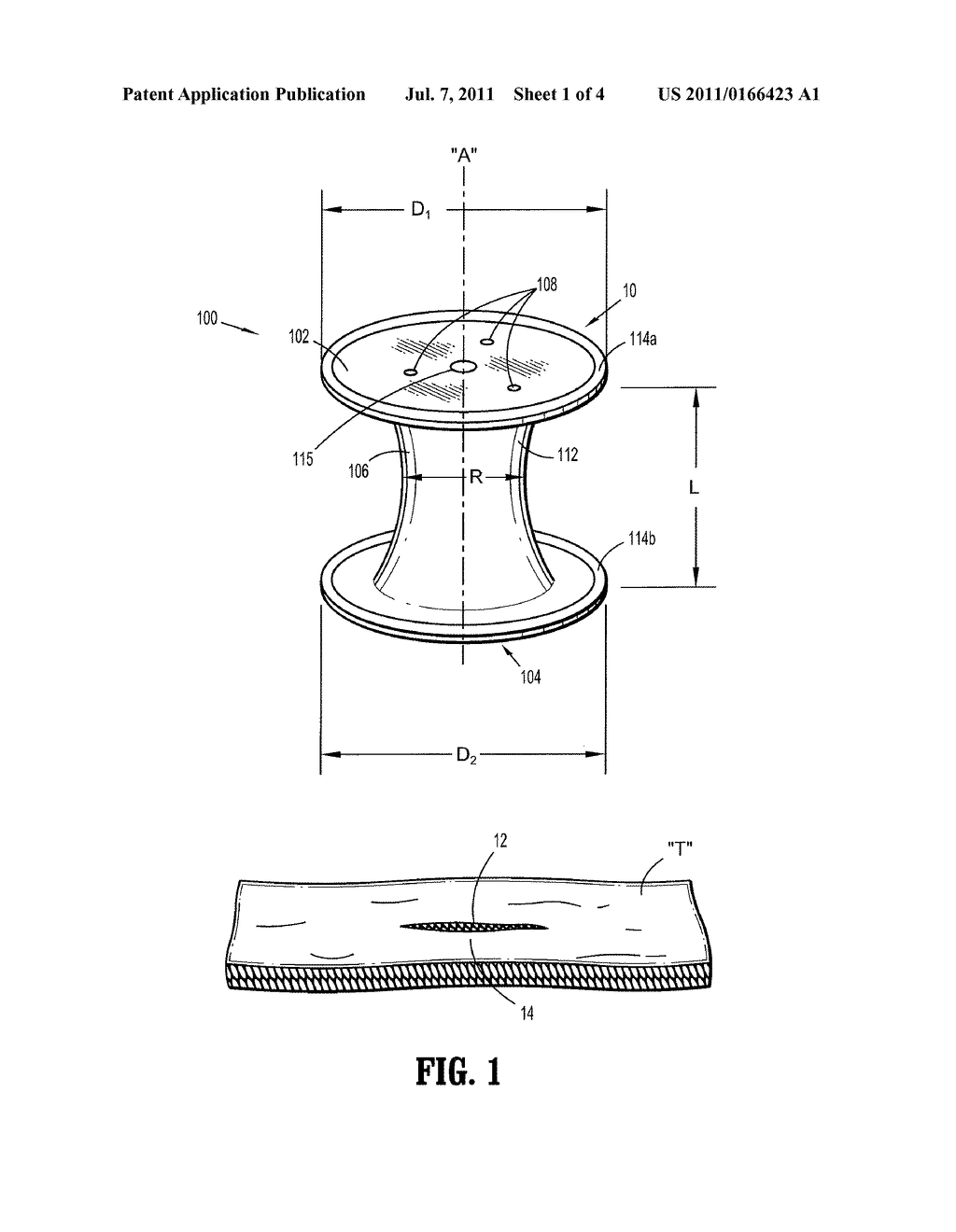 FOAM PORT INTRODUCTION SYSTEM INCLUDING DILATOR - diagram, schematic, and image 02