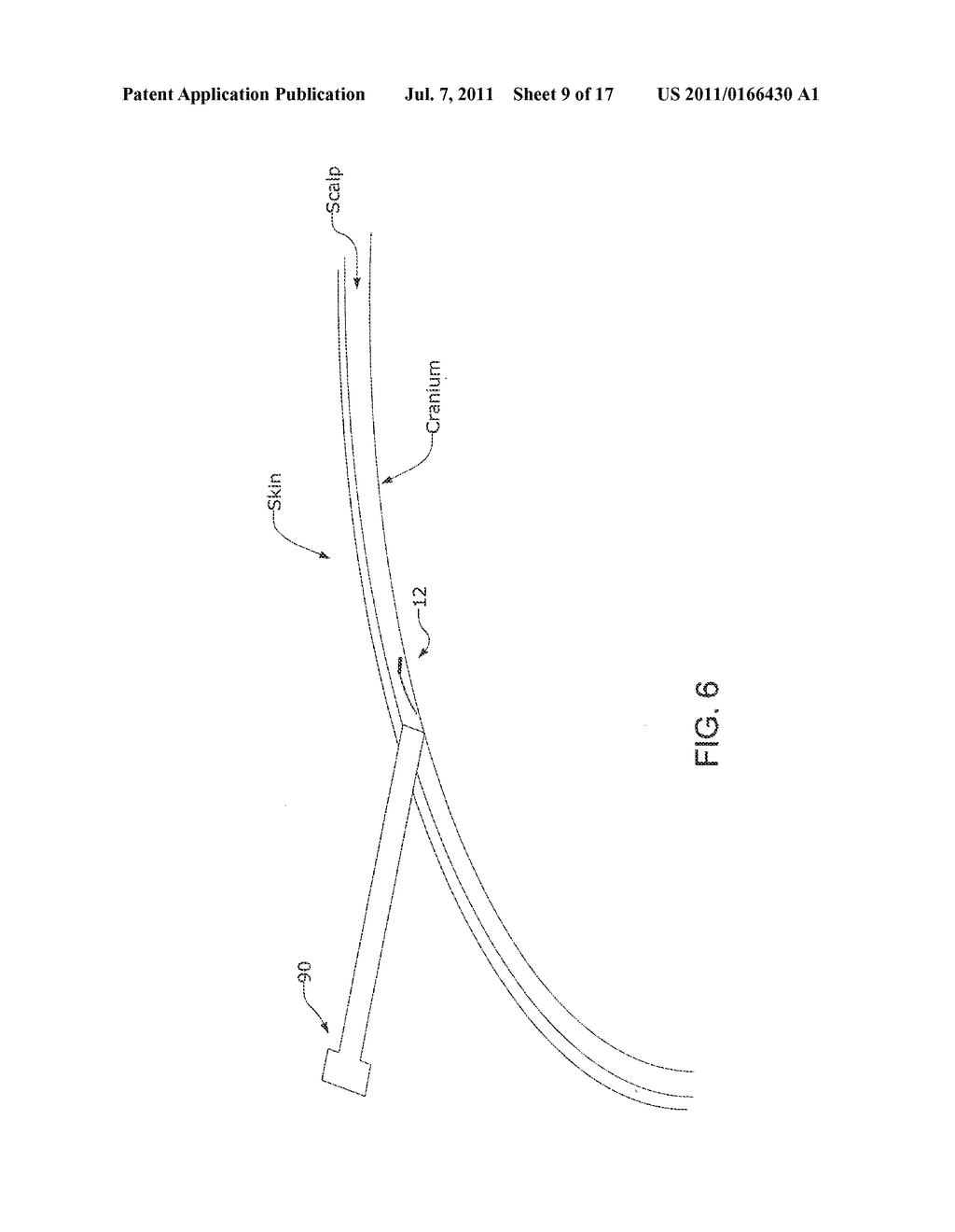 SYSTEM AND METHODS FOR ANALYZING SEIZURE ACTIVITY - diagram, schematic, and image 10