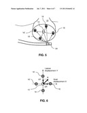 SYSTEM FOR OPTICALLY DETECTING POSITION OF AN INDWELLING CATHETER diagram and image