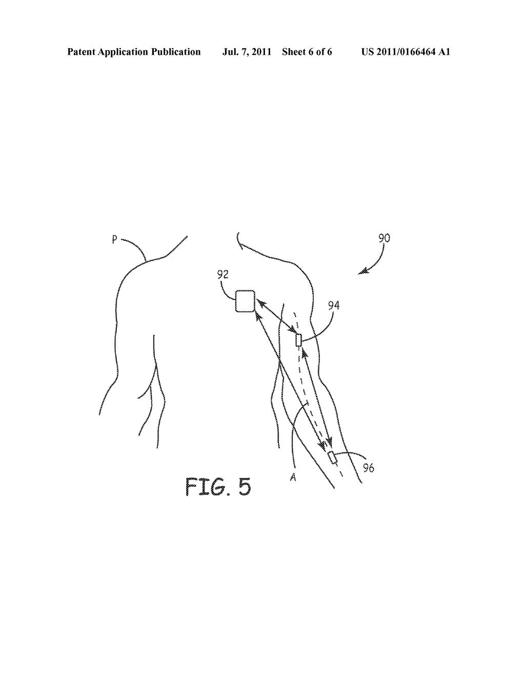 TELEMETRY-SYNCHRONIZED PHYSIOLOGICAL MONITORING AND THERAPY DELIVERY     SYSTEMS - diagram, schematic, and image 07