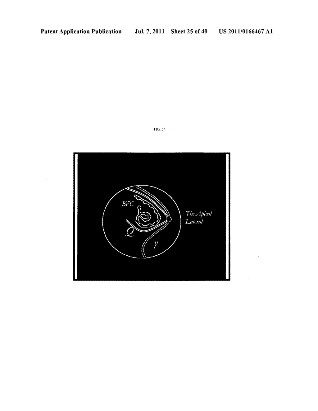 Solution Navier-Stocks Equations of the Blood as a Non-Newtonian Fluid in     the Left Ventricle - diagram, schematic, and image 26