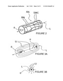 METHODS AND APPARATUS FOR INDUCING CONTROLLED RENAL NEUROMODULATION diagram and image