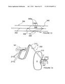 METHODS AND APPARATUS FOR INDUCING CONTROLLED RENAL NEUROMODULATION diagram and image