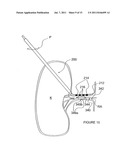 METHODS AND APPARATUS FOR INDUCING CONTROLLED RENAL NEUROMODULATION diagram and image