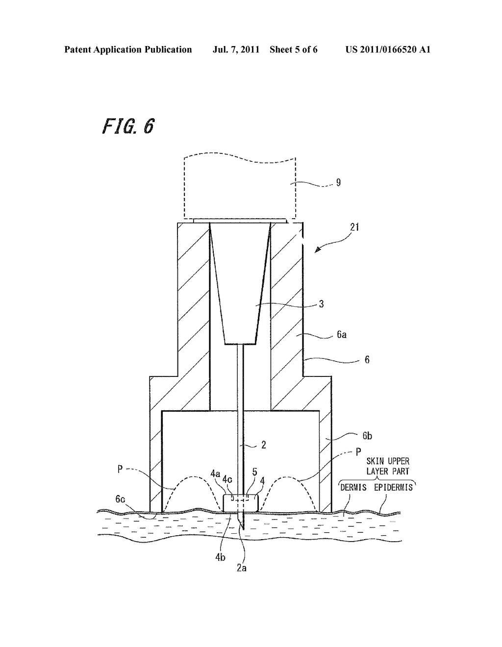 INJECTION NEEDLE AND DRUG INJECTION DEVICE - diagram, schematic, and image 06