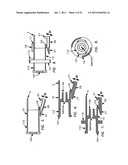 NEEDLE TIP GUARD FOR PERCUTANEOUS ENTRY NEEDLES diagram and image