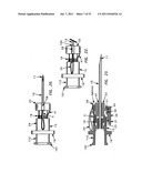 NEEDLE TIP GUARD FOR PERCUTANEOUS ENTRY NEEDLES diagram and image