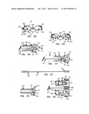 NEEDLE TIP GUARD FOR PERCUTANEOUS ENTRY NEEDLES diagram and image