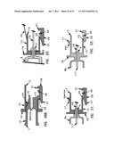 NEEDLE TIP GUARD FOR PERCUTANEOUS ENTRY NEEDLES diagram and image