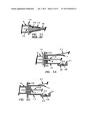 NEEDLE TIP GUARD FOR PERCUTANEOUS ENTRY NEEDLES diagram and image