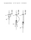 NEEDLE TIP GUARD FOR PERCUTANEOUS ENTRY NEEDLES diagram and image