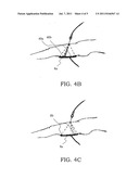 MONOPOLAR ELECTROSURGICAL RETURN ELECTRODE diagram and image