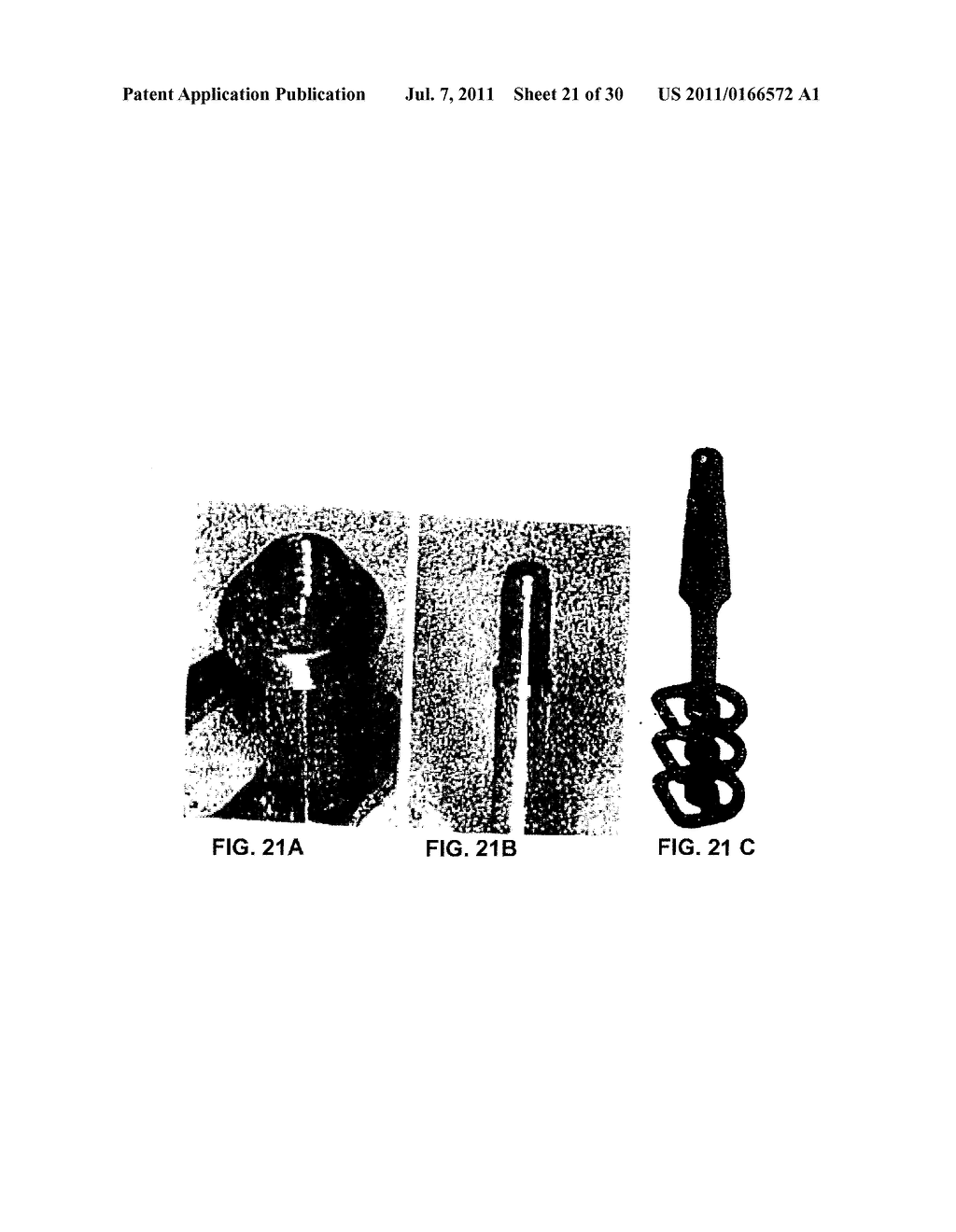 LATERAL IMPLANT SYSTEM AND APPARATUS FOR REDUCTION AND RECONSTRUCTION - diagram, schematic, and image 22