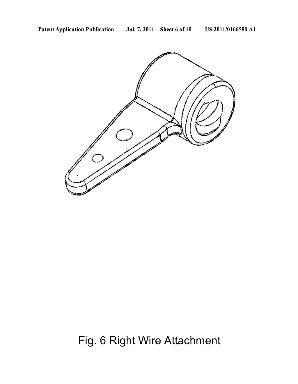 Bone Compression And Distraction Apparatus - diagram, schematic, and image 07