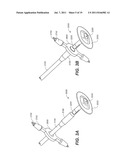 Endoscopic Device Delivery System diagram and image