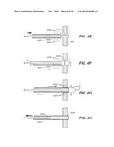 Endoscopic Device Delivery System diagram and image