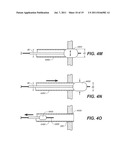 Endoscopic Device Delivery System diagram and image