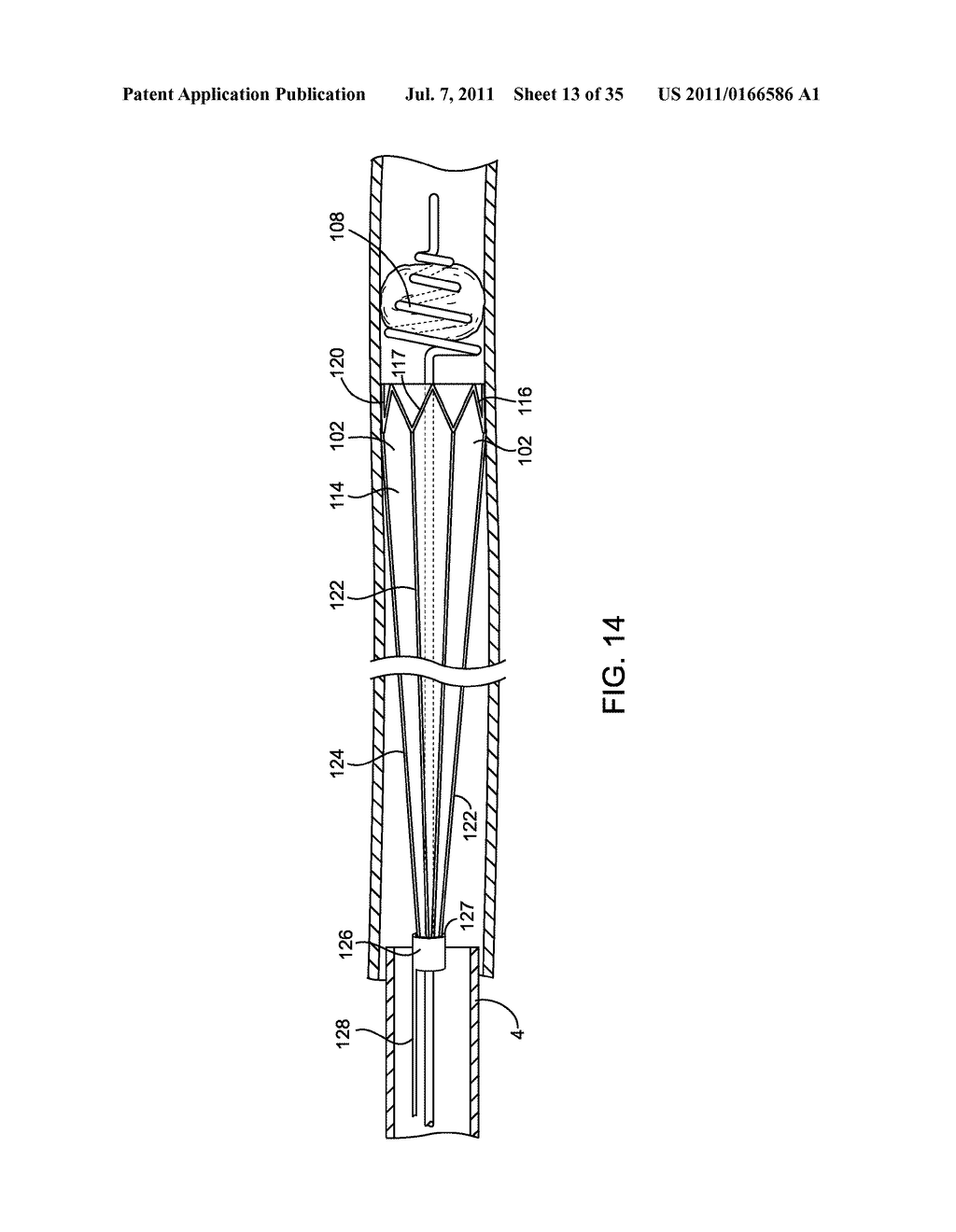 SYSTEMS, METHODS AND DEVICES FOR REMOVING OBSTRUCTIONS FROM A BLOOD VESSEL - diagram, schematic, and image 14