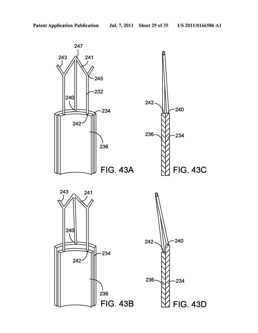 SYSTEMS, METHODS AND DEVICES FOR REMOVING OBSTRUCTIONS FROM A BLOOD VESSEL - diagram, schematic, and image 30