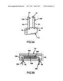 POSTERIOR DYNAMIC STABILIZATION OF SPINE diagram and image