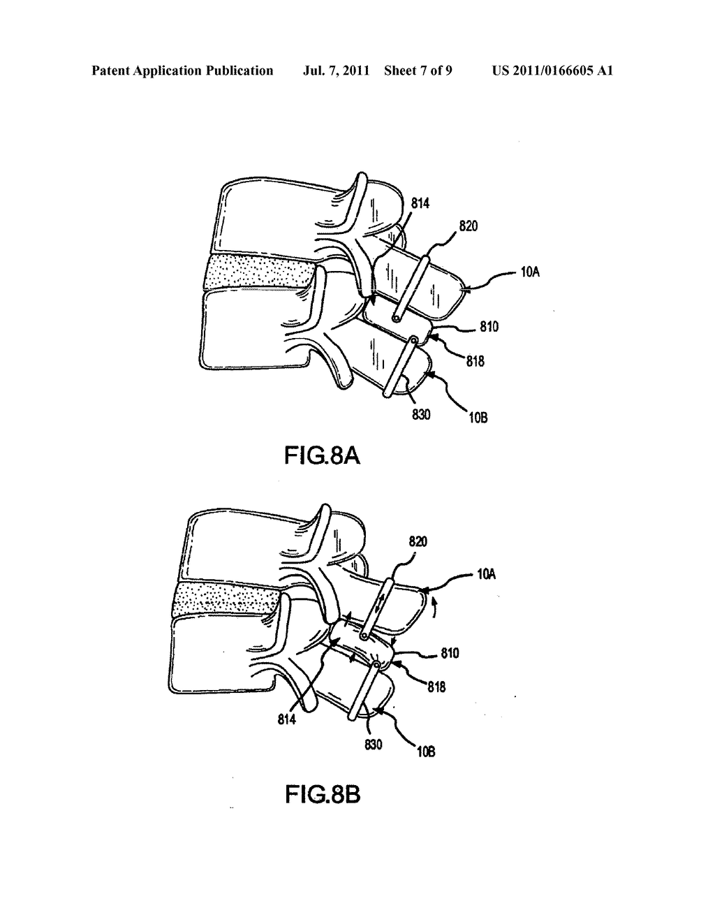 POSTERIOR DYNAMIC STABILIZATION OF SPINE - diagram, schematic, and image 08