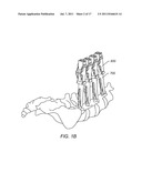 SYSTEMS AND METHODS FOR STABILIZATION OF BONE STRUCTURES, INCLUDING     THOROCOLUMBAR STABILIZATION SYSTEMS AND METHODS diagram and image