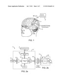 SYSTEMS AND METHODS FOR IMPLANTABLE LEADLESS BRAIN STIMULATION diagram and image