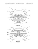 SPINAL IMPLANT CONFIGURED FOR MIDLINE INSERTION diagram and image